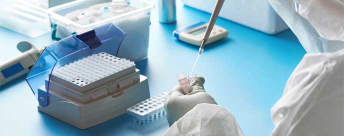 In-Vitro-Diagnostics